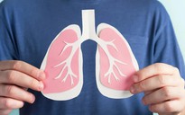 Bác sĩ Trương Hữu Khanh: Sự thật về tin đồn "phổi trắng", "khô phổi"
