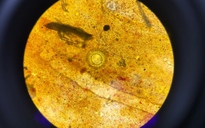 Phát hiện ca mắc sán dây chuột