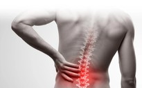 Bài tập đơn giản và hiệu quả nhất để trị chứng đau lưng