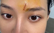 Ồn ào Thùy Anh bị cắt vai, bồi thường hơn 20 tỉ đồng