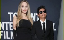 Pax Thiên được Angelina Jolie mời bác sĩ thẩm mỹ trị sẹo