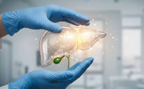 Không chỉ mỡ: Thứ tưởng lành mạnh này cũng gây ra gan nhiễm mỡ