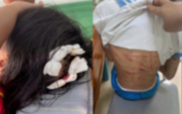 Từ đòn roi trong nhà đến "bạo lực biểu diễn" trên TikTok: Trẻ em đang bị tổn thương ở mọi nơi