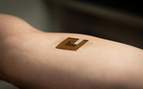 Độc đáo miếng dán phát hiện ung thư da