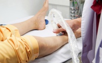 Làm sao biết bị suy giãn tĩnh mạch, chữa trị thế nào?