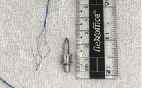 Sau trồng răng implant, bất ngờ phát hiện dị vật mắc trong phế quản