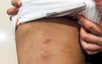 Cà Mau: Tạm dừng hoạt động nhóm trẻ nơi bé gái 2 tuổi bị bạo hành