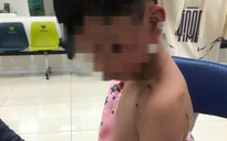 Bé trai bị chó cắn khi đi chúc Tết cùng gia đình