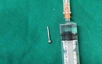 Cô gái 19 tuổi bị khuyên đeo ở lưỡi rơi vào dạ dày trong lúc ăn