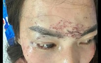 Khởi tố vụ bắt người phụ nữ đem về xăm, cắt tóc và đánh đập gây chấn động dư luận ở Cà Mau