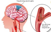 Kịp cứu một người Nga bị đột quỵ cấp ở Nha Trang chuyển về TP HCM