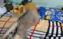 Điều tra nguyên nhân tử vong bất thường của một cụ bà ở Gia Lai