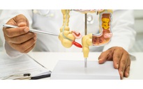 "Bệnh ung thư bị lãng quên” tăng bất thường ở người trẻ