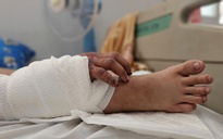 Ca ghép tay vào chân cho cô gái trẻ mang song thai: Đã thực hiện 1 ca tương tự trước đó 