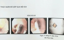 Bác sĩ cảnh báo một tai nạn nguy hiểm dễ gặp ở người già