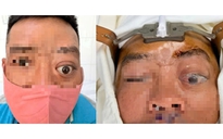 Một ca bệnh mà Bệnh viện Tai Mũi Họng TPHCM mới gặp lại trong vòng 20 năm 