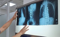 Bộ Y tế đề nghị không lấy thời gian chụp X-quang để từ chối BHYT