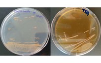 Sinh vật cực nguy hiểm lộ ra từ băng hang động 5.000 năm