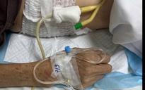 Cụ ông nhiều ngày bí tiểu, nước tiểu trắng đục như sữa