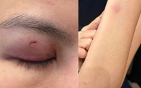 Công an phường Sài Gòn xác minh vụ ca sĩ Trung Quân Idol đánh phụ nữ