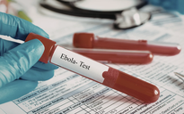 TPHCM tăng cường giám sát cửa khẩu, chủ động phòng nguy cơ dịch bệnh Ebola xâm nhập