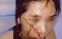 Nhóm dùng dao lam rạch nát mặt cô gái lãnh 9 năm tù