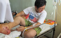 Đụng phải trâu, 40 du khách Việt gặp nạn ở Campuchia