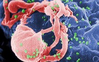 Chữa bệnh AIDS bằng thuốc trị ung thư