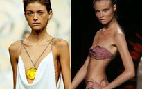 “Cấm vận” siêu mẫu trơ xương