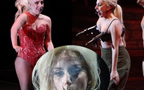 Lady Gaga hút cần sa, diện trang phục "thịt" trên sân khấu