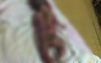 Kinh hoàng bé sơ sinh bị “nướng” chết tại bệnh viện