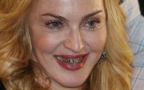 Madonna lại khoe hàm răng vàng lấp lánh
