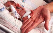 Em bé nhỏ nhất thế giới ra đời tại Mỹ
