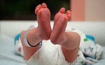 Nên cắt rốn sau khi trẻ chào đời 3 phút