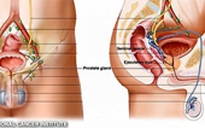 Hầu hết đàn ông không biết tuyến tiền liệt để làm gì