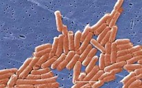 Mỹ: Thu hồi bơ lạc vì chứa khuẩn salmonella