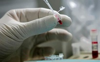 Nhật Bản phát hiện biến thể mới của virus cúm A/H1N1