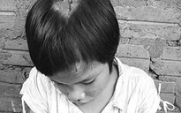 Chị ruột cháu Hảo bị cha hành hạ dã man