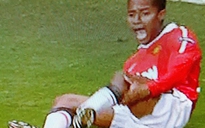 Tiền vệ MU bị đá gãy chân ngay trên sân