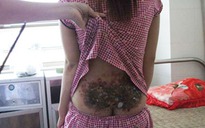 Không chịu lấy chồng, bị đánh dã man