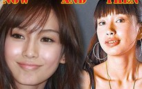 Dương Dĩnh được giải oan vụ "dao kéo"