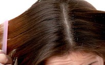 Hiểu gàu để trị gàu