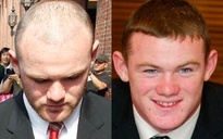 Rooney “hói vẫn hoàn… hói”