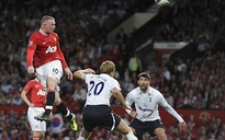Rooney thi đấu lên chân nhờ… chữa hói