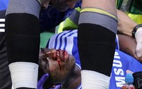 Bất tỉnh, “voi rừng” Drogba phải nhập viện