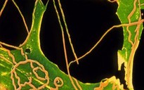 83 người chết trong thí nghiệm ghê rợn