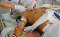 Cứu sống bệnh nhân tim ngừng đập