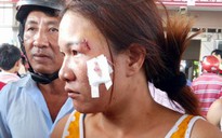 Chủ cây xăng thuê côn đồ chém, bắn người bán hàng rong
