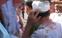 Một công nhân bị bảo vệ đánh vỡ đầu