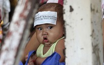 61 trẻ em tử vong vì bệnh lạ ở Campuchia